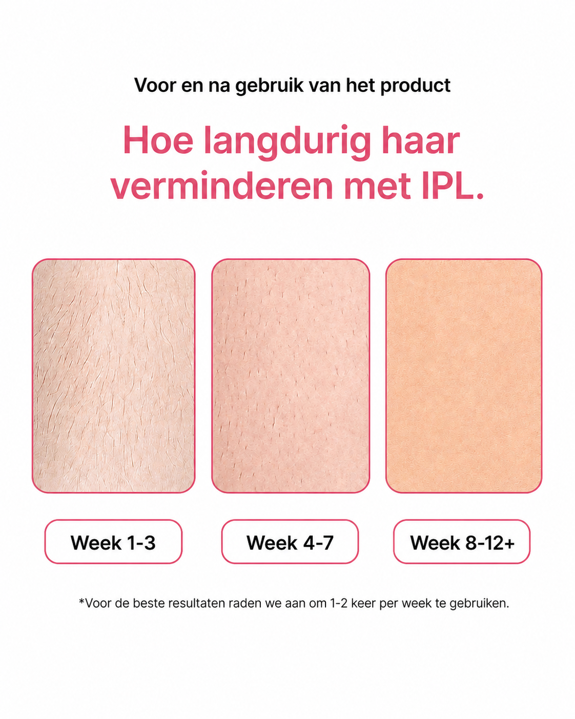 Smoothly: IPL Laser Ontharingsapparaat